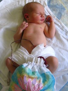 Lotus Birth, bimbo con Placenta e cordone ombelicale
